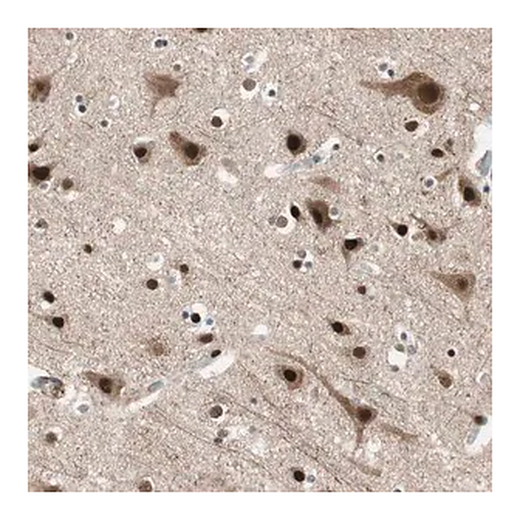 Merck Anti-FBXO44 antibody produced in rabbit