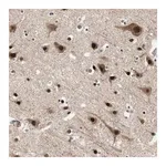 Merck Anti-FBXO44 antibody produced in rabbit