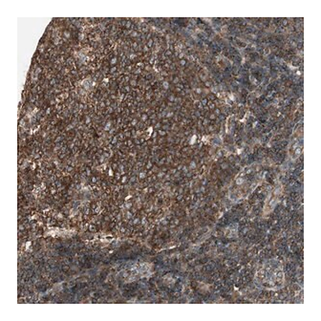 Merck Anti-CHADL antibody produced in rabbit