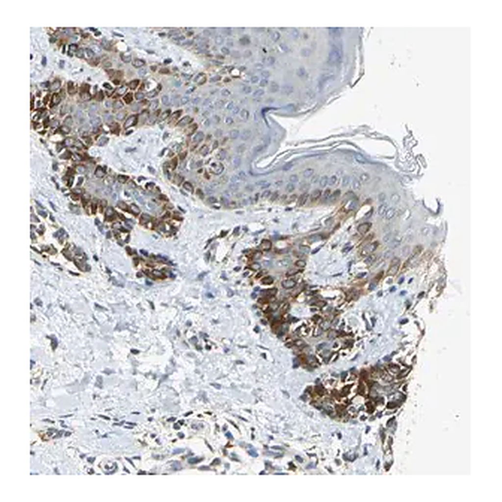 Merck Anti-NPHP3 antibody produced in rabbit