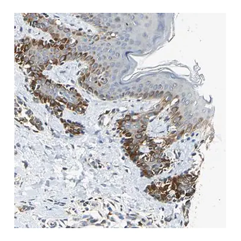 Merck Anti-NPHP3 antibody produced in rabbit
