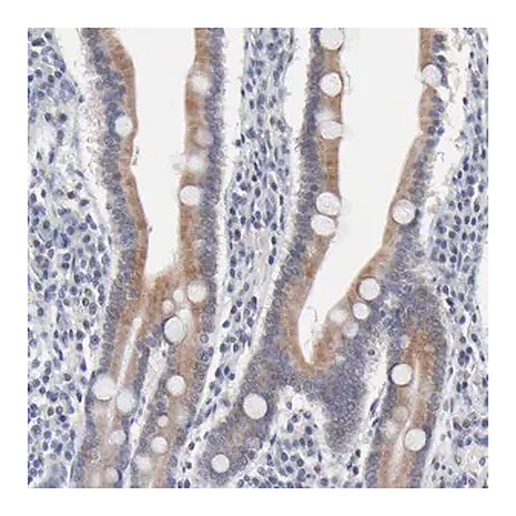 Merck Anti-AADAC antibody produced in rabbit