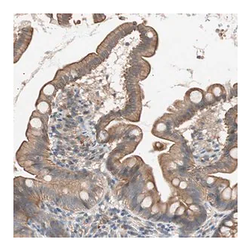 Merck Anti-SMG1 antibody produced in rabbit