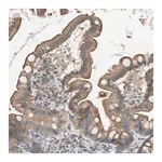 Merck Anti-SMG1 antibody produced in rabbit