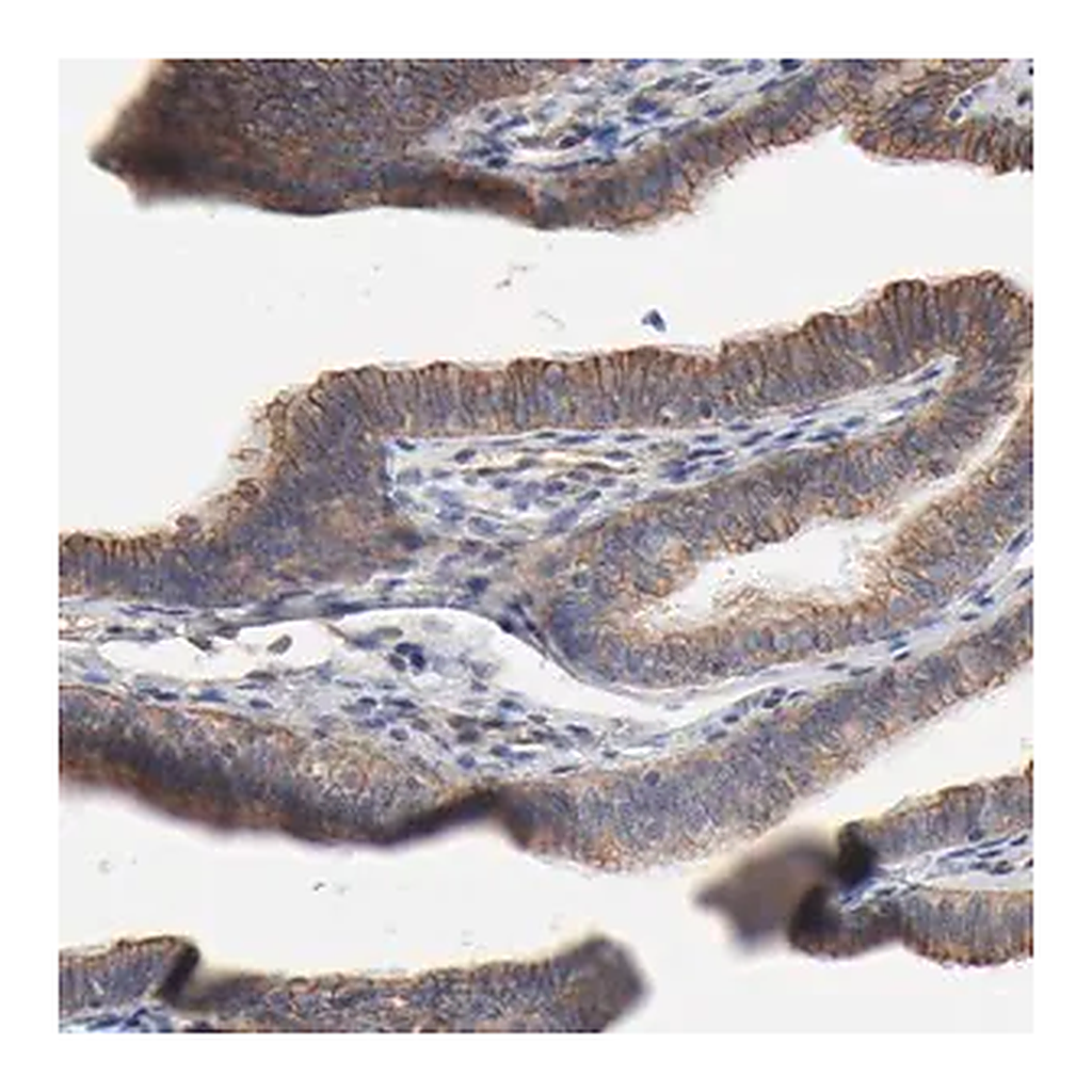 Merck Anti-ABCD4 antibody produced in rabbit