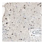 Merck Anti-ADAMTS5 antibody produced in rabbit