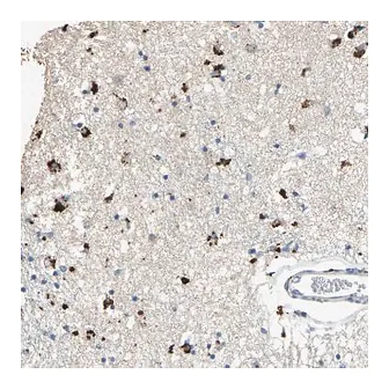Merck Anti-ADAMTS5 antibody produced in rabbit