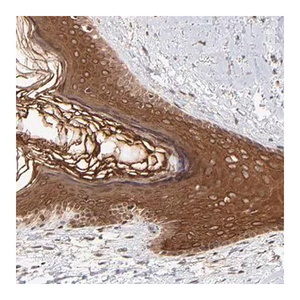 Merck Anti-TNRC6B antibody produced in rabbit