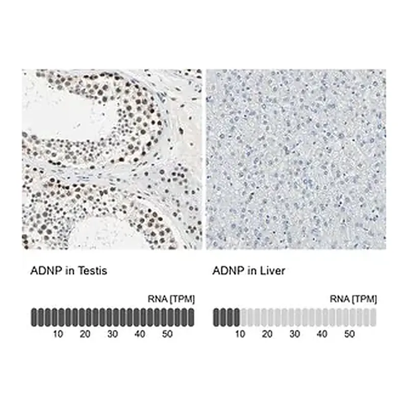 Merck Anti-ADNP antibody produced in rabbit