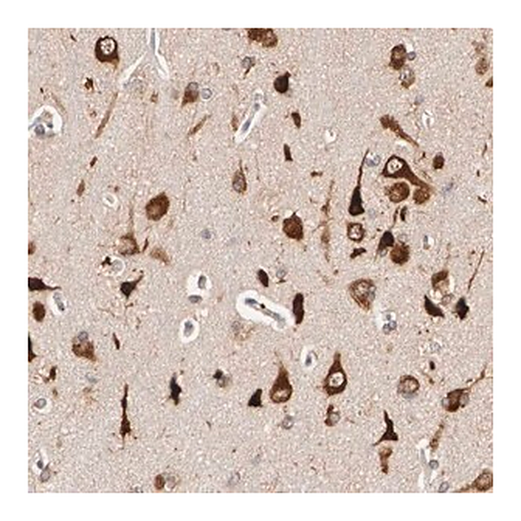 Merck Anti-FKBP3 antibody produced in rabbit