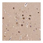 Merck Anti-TOM1 antibody produced in rabbit