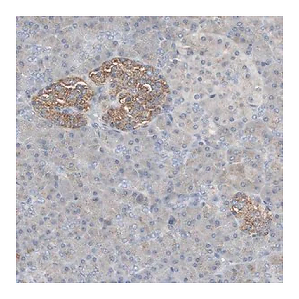 Merck Anti-GBA antibody produced in rabbit