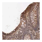 Merck Anti-ARMCX4 antibody produced in rabbit