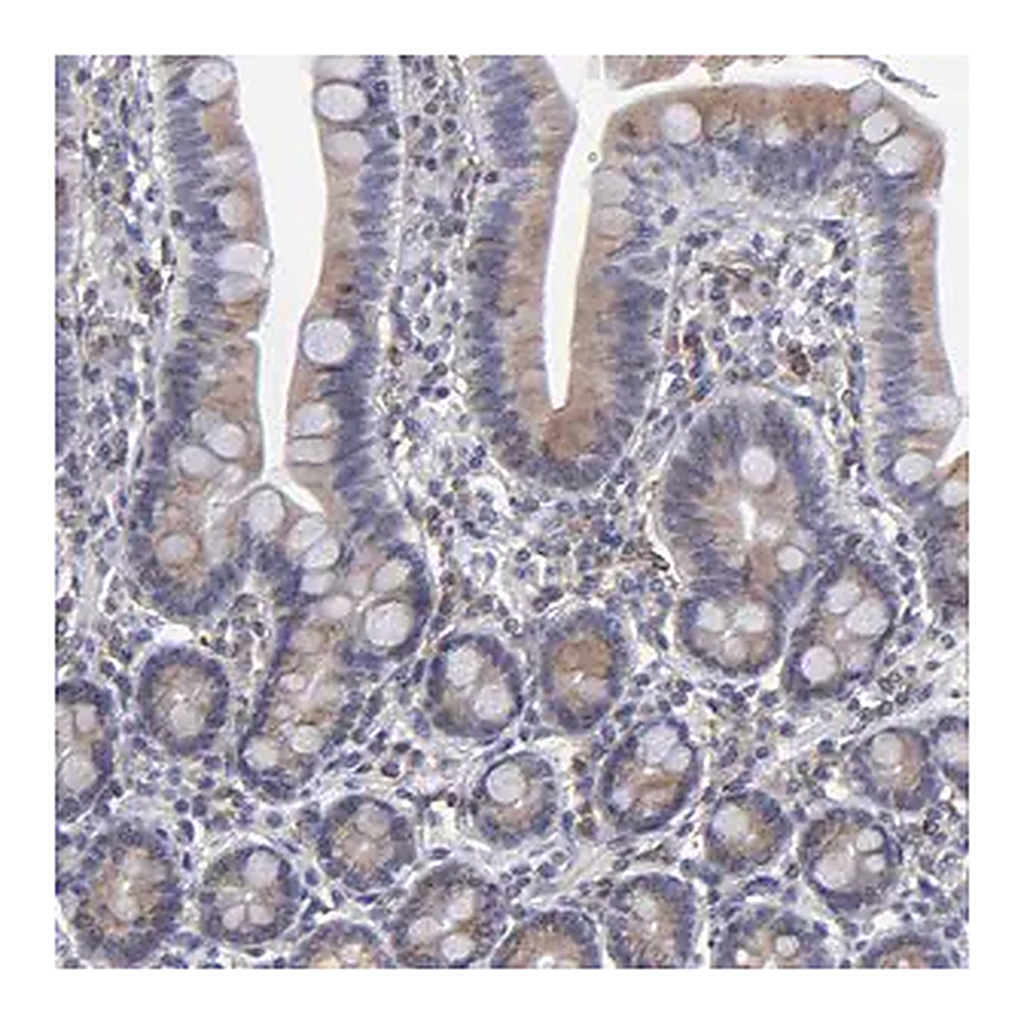 Merck Anti-TMX1 antibody produced in rabbit