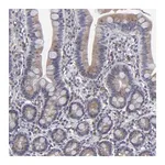Merck Anti-TMX1 antibody produced in rabbit