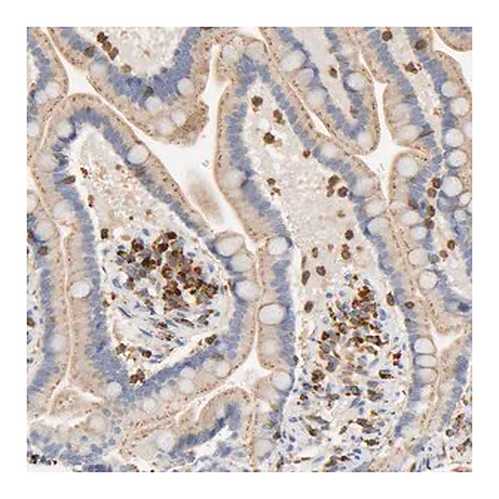 Merck Anti-UCKL1 antibody produced in rabbit