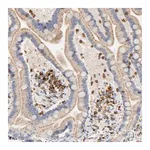 Merck Anti-UCKL1 antibody produced in rabbit