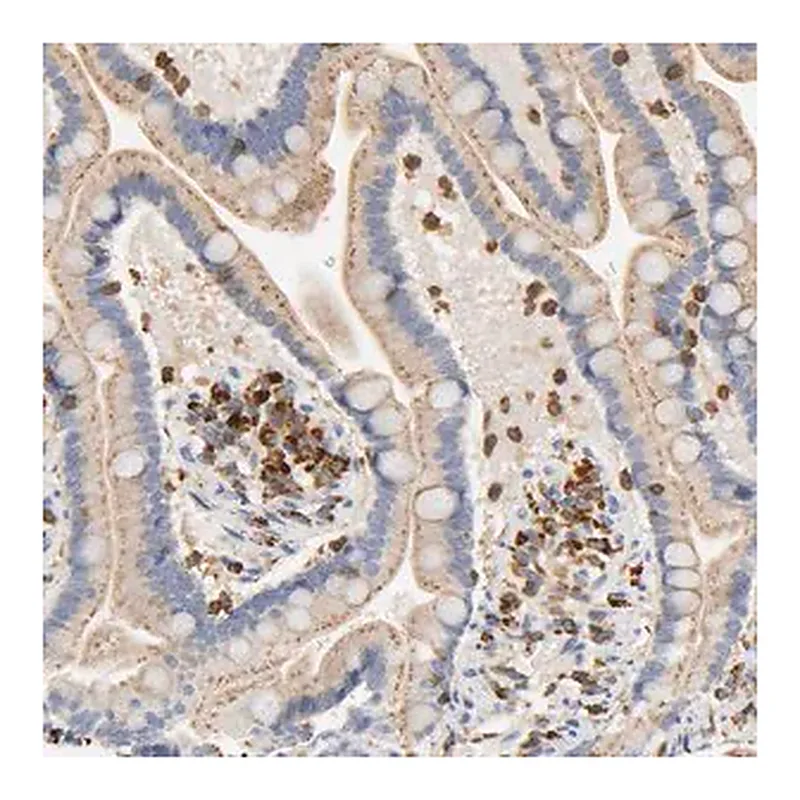 Merck Anti-UCKL1 antibody produced in rabbit