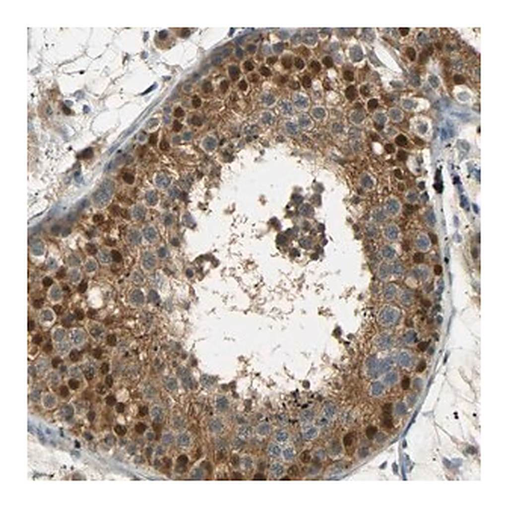 Merck Anti-USP13 antibody produced in rabbit