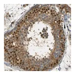 Merck Anti-USP13 antibody produced in rabbit