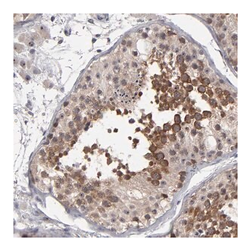 Merck Anti-GLCCI1 antibody produced in rabbit