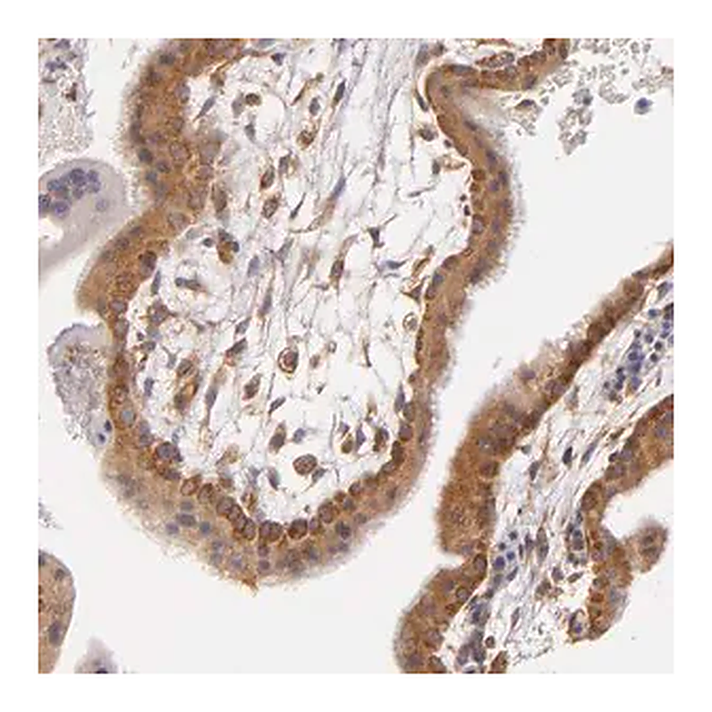 Merck Anti-UPF3B antibody produced in rabbit