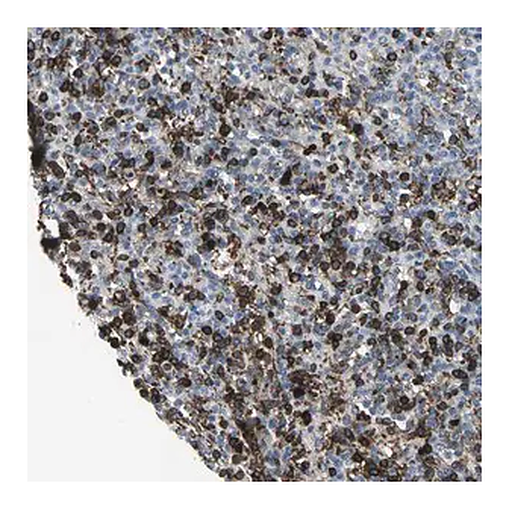 Merck Anti-GLI3 antibody produced in rabbit