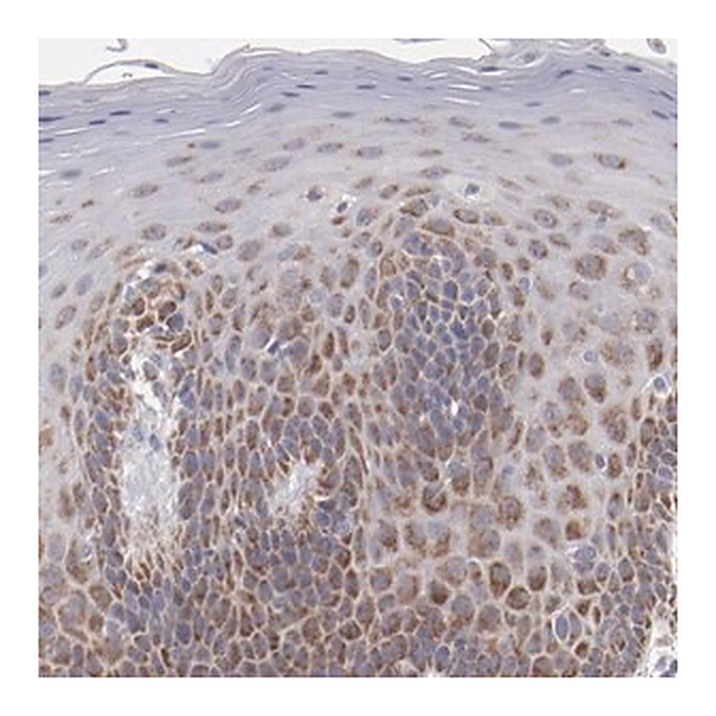 Merck Anti-HCCS antibody produced in rabbit