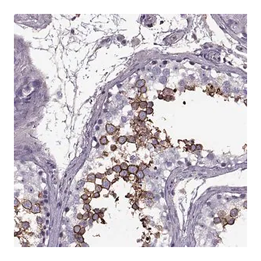 Merck Anti-SLC2A3 antibody produced in rabbit