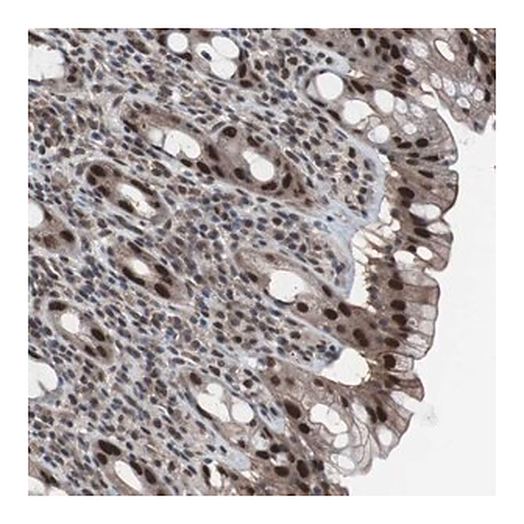 Merck Anti-GTF2F2 antibody produced in rabbit