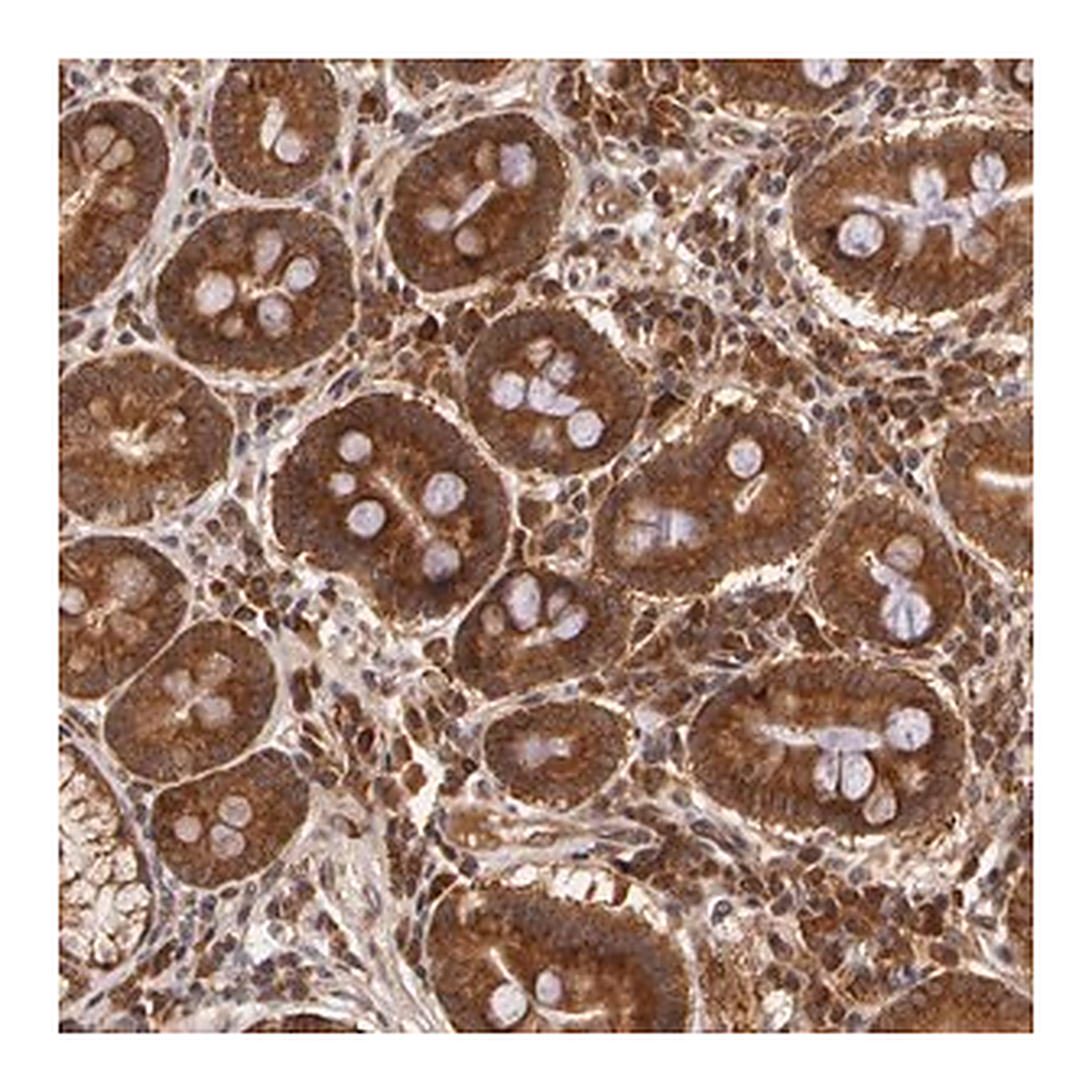 Merck Anti-ASCC2 antibody produced in rabbit