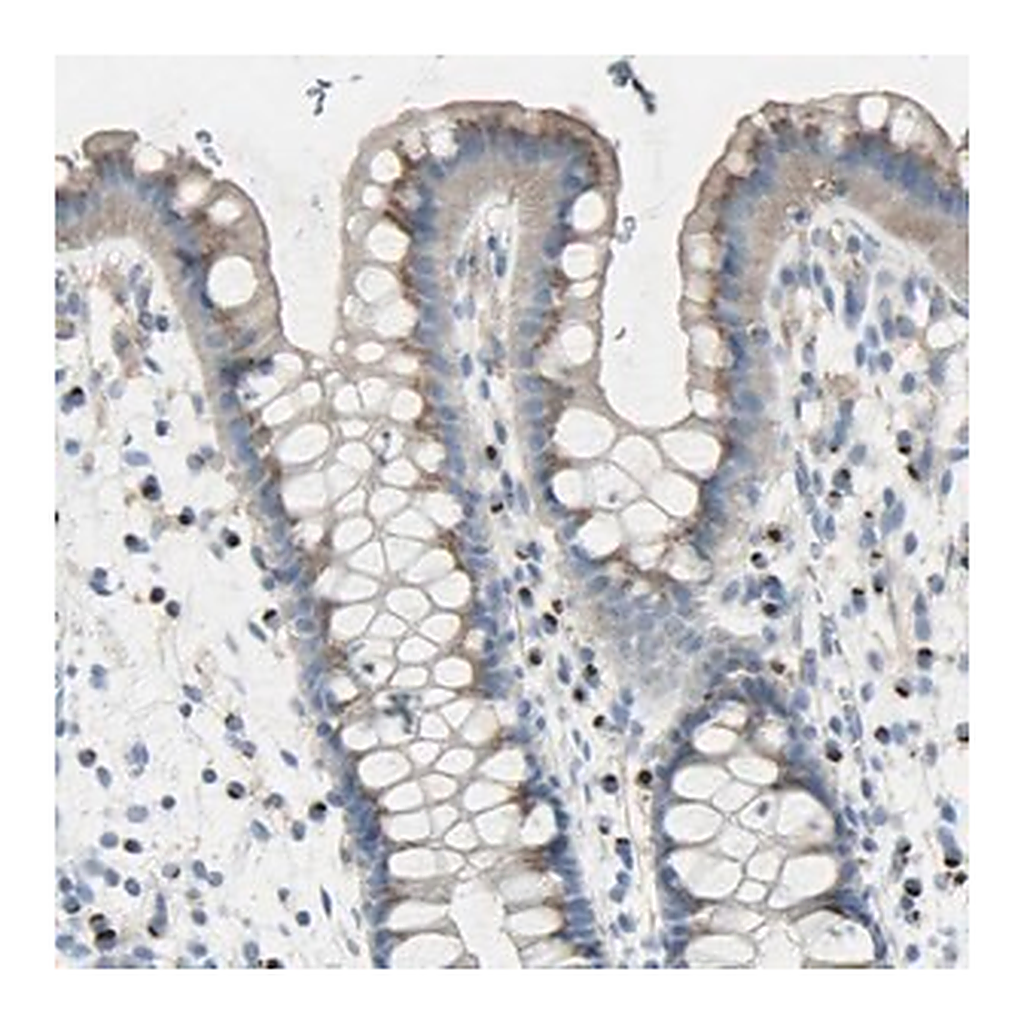 Merck Anti-B4GALT3 antibody produced in rabbit