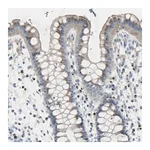 Merck Anti-B4GALT3 antibody produced in rabbit
