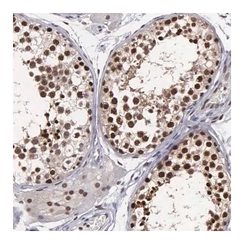 Merck Anti-UBR7 antibody produced in rabbit