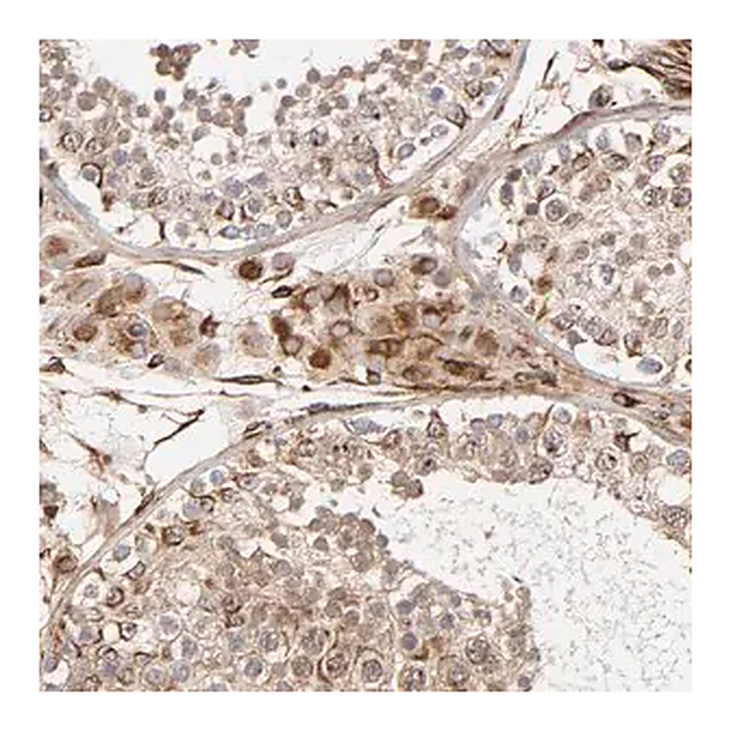 Merck Anti-DNAAF2 antibody produced in rabbit