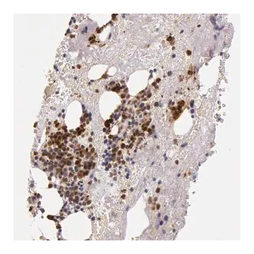 Merck Anti-KDM6A antibody produced in rabbit