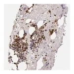 Merck Anti-KDM6A antibody produced in rabbit