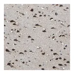 Merck Anti-NSD3 antibody produced in rabbit