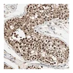 Merck Anti-USP5 antibody produced in rabbit
