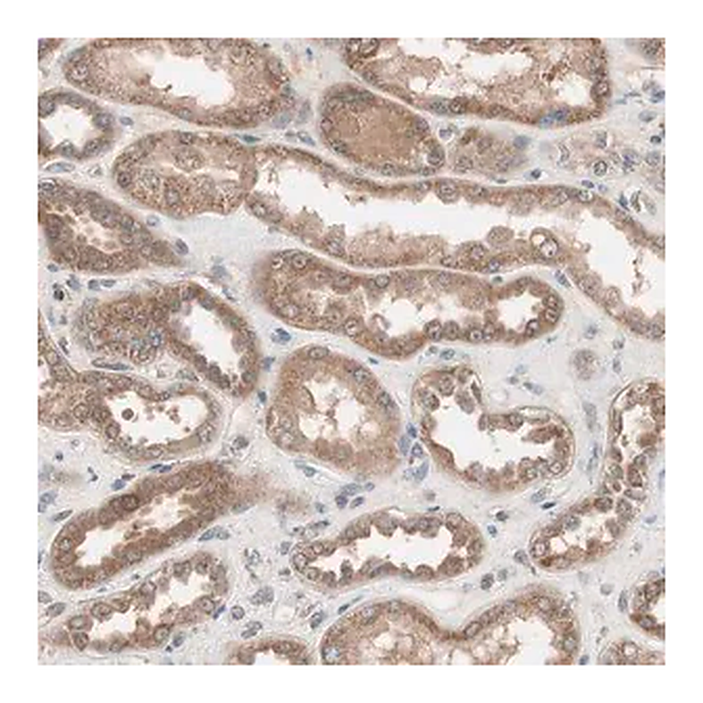 Merck Anti-HMBS antibody produced in rabbit