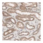 Merck Anti-HMBS antibody produced in rabbit