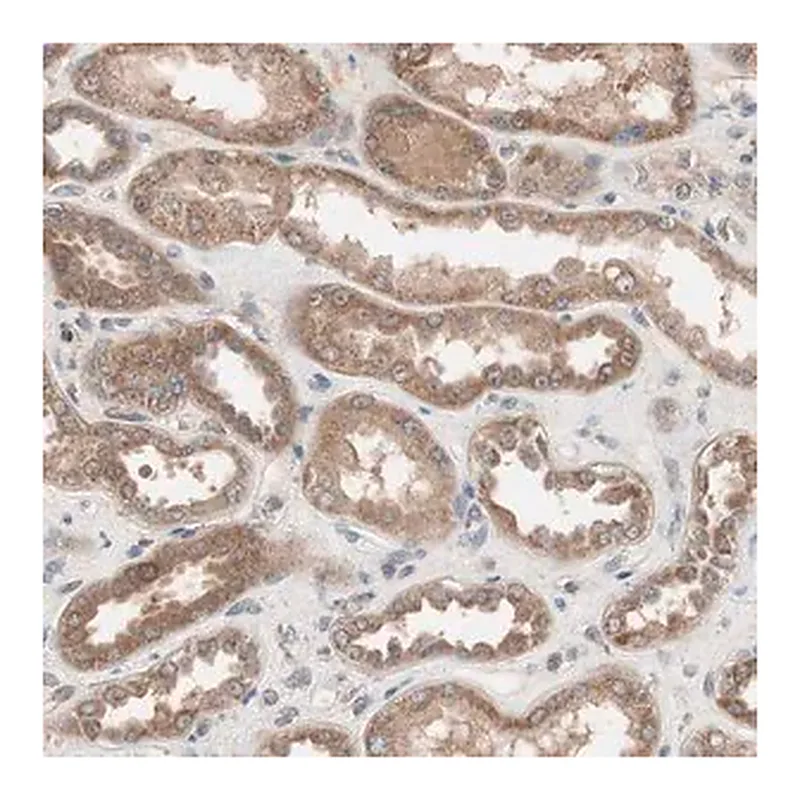 Merck Anti-HMBS antibody produced in rabbit