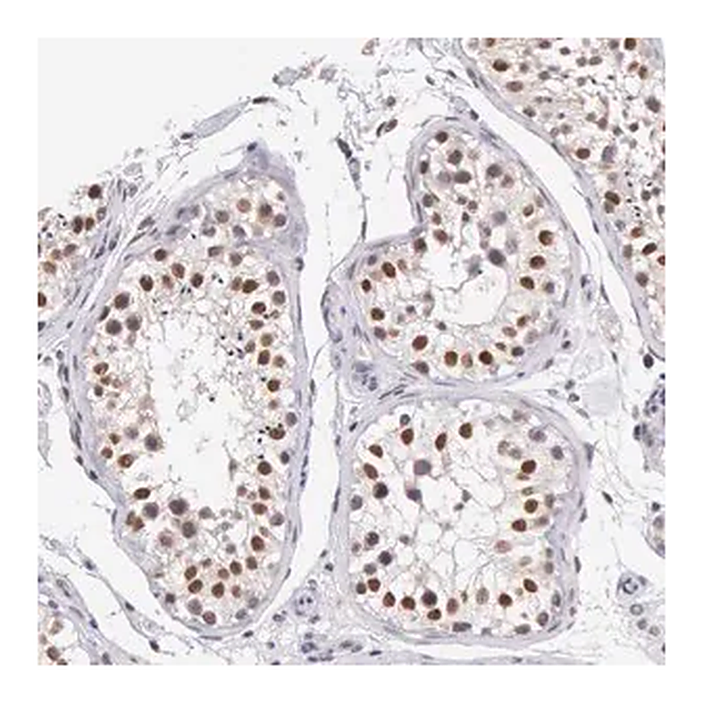 Merck Anti-HMGXB4 antibody produced in rabbit