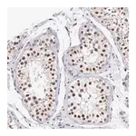 Merck Anti-HMGXB4 antibody produced in rabbit