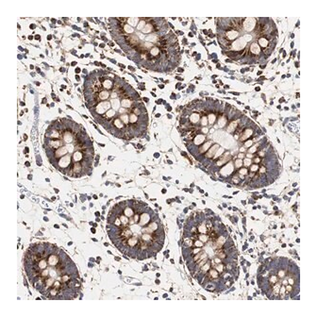 Merck Anti-HSD17B10 antibody produced in rabbit