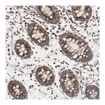 Merck Anti-HSD17B10 antibody produced in rabbit