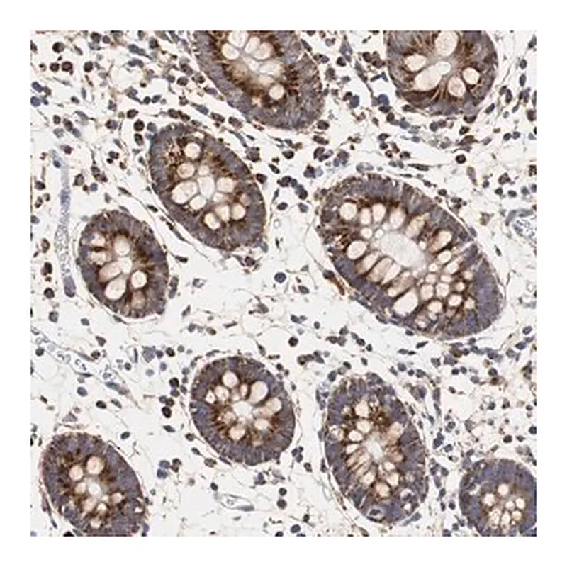 Merck Anti-HSD17B10 antibody produced in rabbit