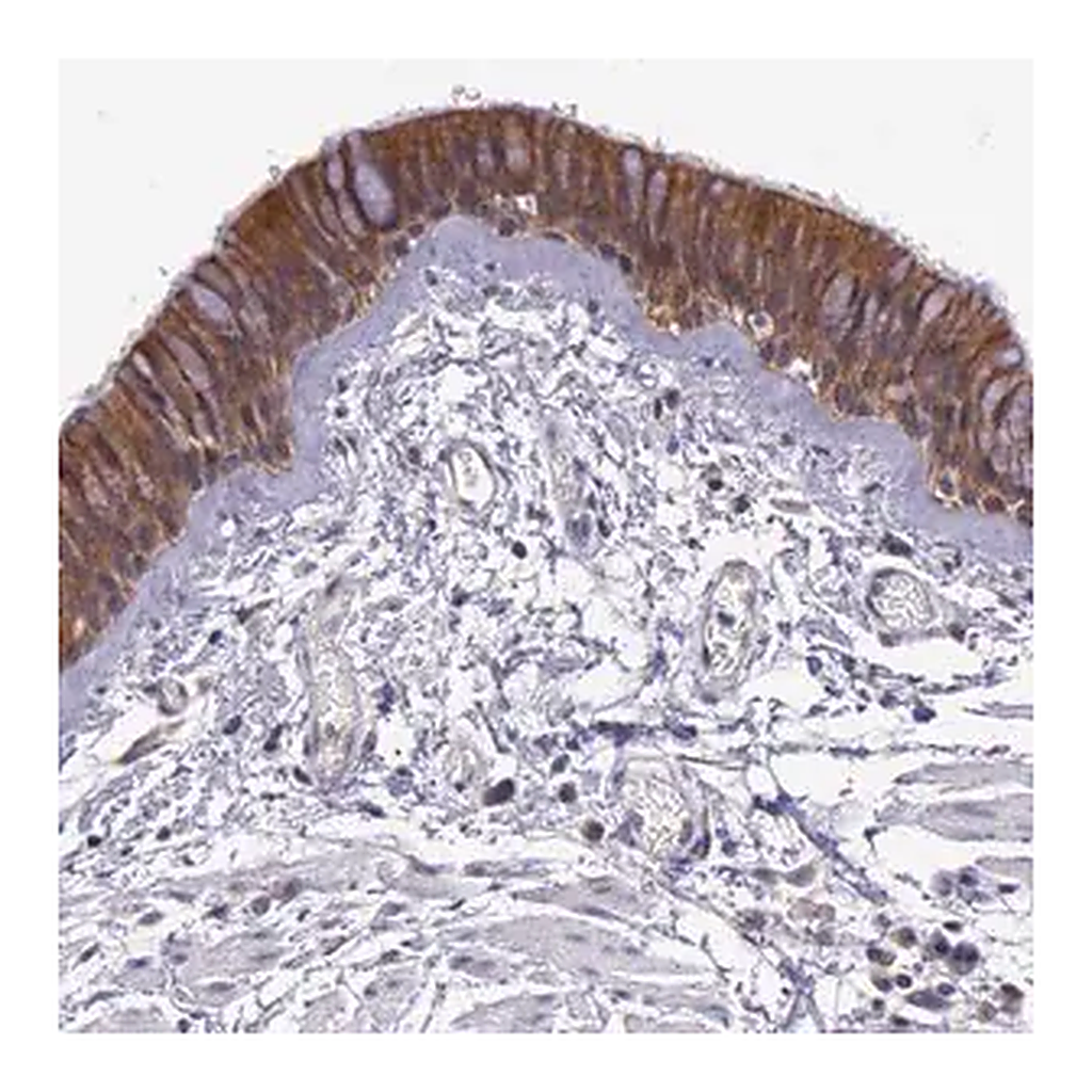 Merck Anti-IGBP1 antibody produced in rabbit