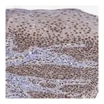 Merck Anti-TRMT2A antibody produced in rabbit