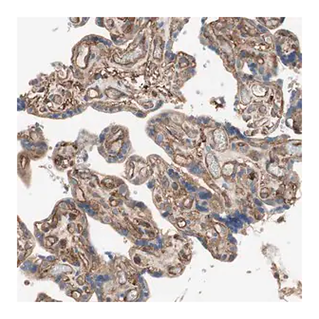 Merck Anti-IL1RL1 antibody produced in rabbit